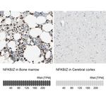 IkB zeta Antibody in Immunohistochemistry (IHC)