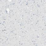 IkB zeta Antibody in Immunohistochemistry (IHC)