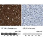 ATP1B2 Antibody
