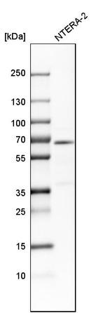 DPYSL3 Antibody in Western Blot (WB)