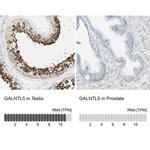 GALNTL5 Antibody in Immunohistochemistry (IHC)