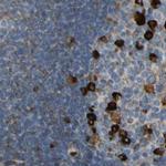 TRAP alpha Antibody in Immunohistochemistry (IHC)