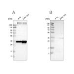 TRAP alpha Antibody in Western Blot (WB)