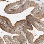 Stomatin Antibody in Immunohistochemistry (IHC)