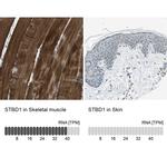 STBD1 Antibody in Immunohistochemistry (IHC)