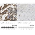 LASP1 Antibody in Immunohistochemistry (IHC)