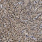 ACBD5 Antibody in Immunohistochemistry (IHC)