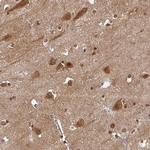 OMG Antibody in Immunohistochemistry (IHC)