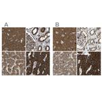 C1GALT1 Antibody in Immunohistochemistry (IHC)