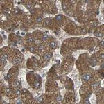 C1GALT1 Antibody in Immunohistochemistry (IHC)