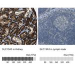 SLC13A3 Antibody in Immunohistochemistry (IHC)