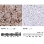 Aquaporin 4 Antibody in Immunohistochemistry (IHC)