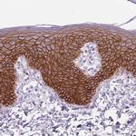 Aquaporin 3 Antibody in Immunohistochemistry (IHC)