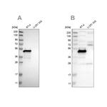 TES Antibody in Western Blot (WB)