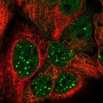 MST1 (STK4) Antibody in Immunocytochemistry (ICC/IF)