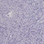 NDRG4 Antibody in Immunohistochemistry (IHC)