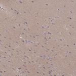 NDRG4 Antibody in Immunohistochemistry (IHC)