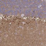 NDRG4 Antibody in Immunohistochemistry (IHC)