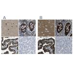 WNK2 Antibody in Immunohistochemistry (IHC)