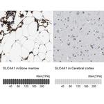 SLC4A1 Antibody in Immunohistochemistry (IHC)