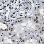 NSRP1 Antibody in Immunohistochemistry (IHC)