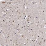 Kiaa0319 Antibody in Immunohistochemistry (IHC)