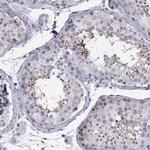 BAG5 Antibody in Immunohistochemistry (IHC)