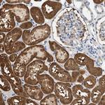 SLC35E1 Antibody in Immunohistochemistry (IHC)