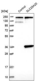 SLC25A20 Antibody in Western Blot (WB)