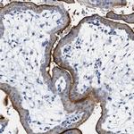 NAALADL2 Antibody in Immunohistochemistry (IHC)