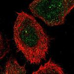 CHST15 Antibody in Immunocytochemistry (ICC/IF)