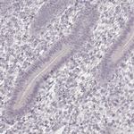 LY6K Antibody in Immunohistochemistry (IHC)