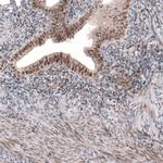 TNRC6A Antibody in Immunohistochemistry (IHC)