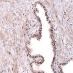 TNRC6A Antibody in Immunohistochemistry (IHC)