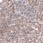 TNRC6A Antibody in Immunohistochemistry (IHC)