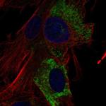 COL15A1 Antibody in Immunocytochemistry (ICC/IF)