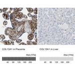 COL15A1 Antibody in Immunohistochemistry (IHC)