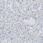 COL15A1 Antibody in Immunohistochemistry (IHC)