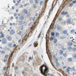 COL15A1 Antibody in Immunohistochemistry (IHC)