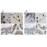 G3BP2 Antibody in Immunohistochemistry (IHC)