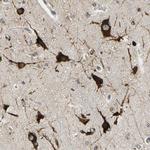 G3BP2 Antibody in Immunohistochemistry (IHC)