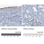 UPK3A Antibody in Immunohistochemistry (IHC)