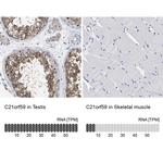 C21orf59 Antibody