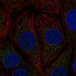 KNP-I Antibody in Immunocytochemistry (ICC/IF)