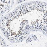 HOOK1 Antibody in Immunohistochemistry (IHC)