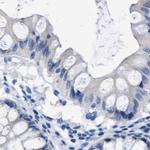 HOOK1 Antibody in Immunohistochemistry (IHC)