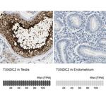 TXNDC2 Antibody