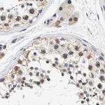 Nuclear Matrix Protein p84 Antibody in Immunohistochemistry (IHC)