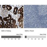 GDA Antibody in Immunohistochemistry (IHC)
