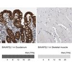 BAIAP2L1 Antibody in Immunohistochemistry (IHC)